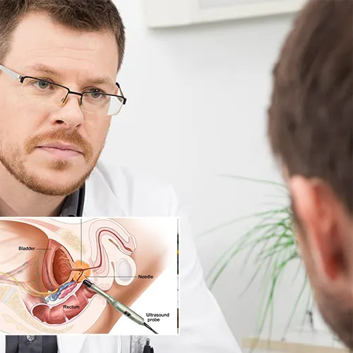Understanding Penile Implant Surgery at Baylor Scott & White Surgical Hospital 

