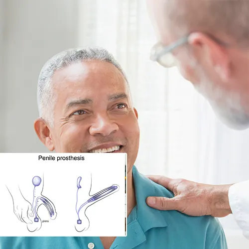 Why Choose  Baylor Scott & White Surgical Hospital 
for Your Penile Implant Surgery?